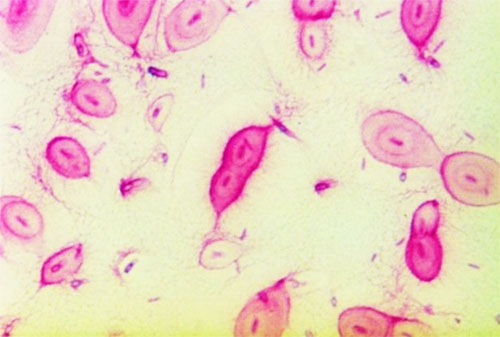 膠凍樣芽孢桿菌作用